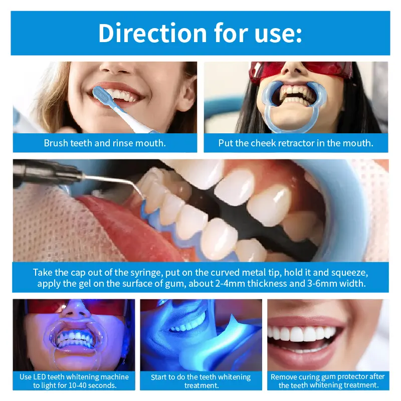 Professional Gum Protector Gel Syringe GW-GP01N-02 (3)zy1