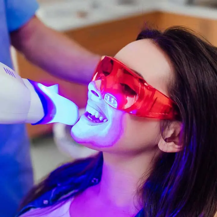 In-Office Teeth Whitening Solutions019of