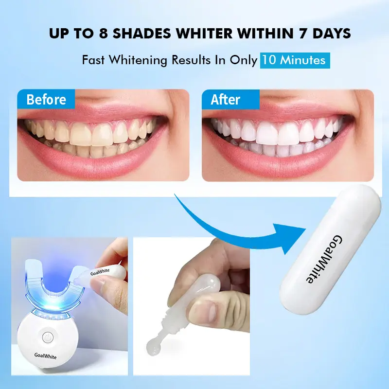 OEM Teeth Whitening Home Kit With PAP+ Peroxide Free Gel Pods and LED light
