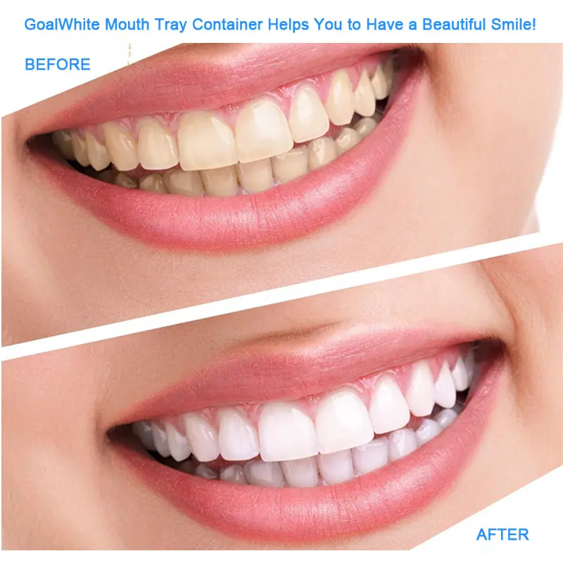 Mouth Tray Box GW-TB05 05.jpg