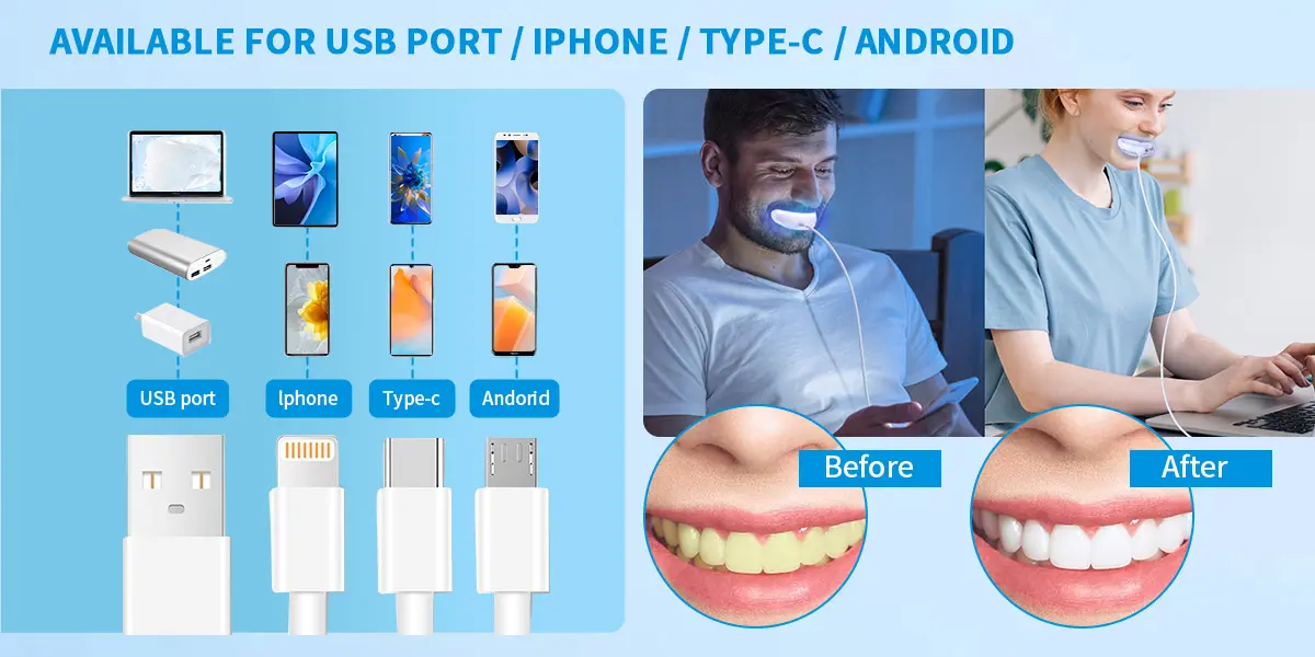 LED teeth whitening home kit GW-HK101B 007lxj