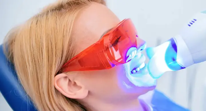 How to Start a Teeth Whitening Business