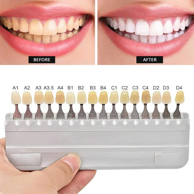 Teeth whitening shade guide GW-SGV16 002ze7