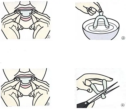 usage-instructions-for-thermoforming-mouth-traysv6b