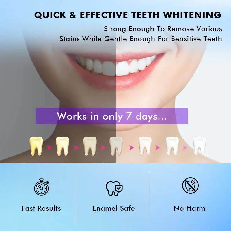 Custom Advanced V34 Colour Corrector Dry Teeth Whitening Strips For Yellow Teeth