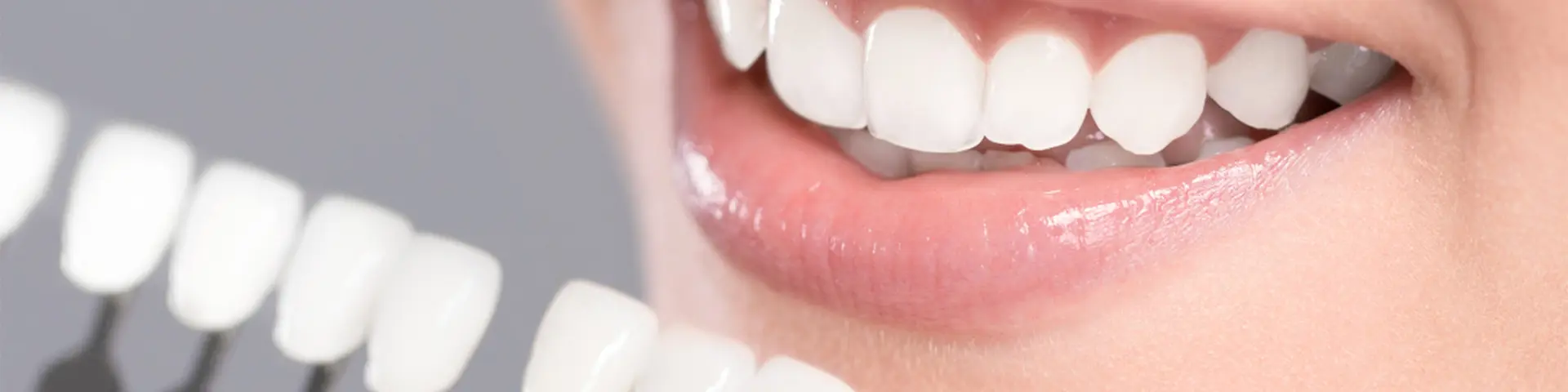 Exploring The Latest Teeth Whitening Trends of 2024: What's New