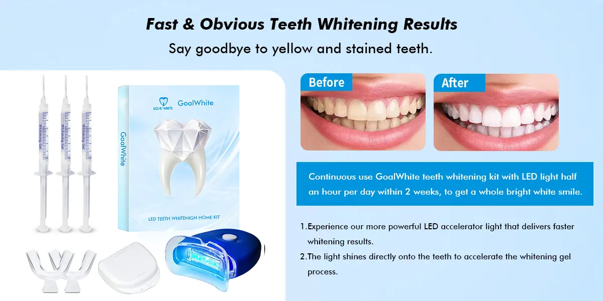 LED Teeth whitening home kit GW-HK002 005gfx