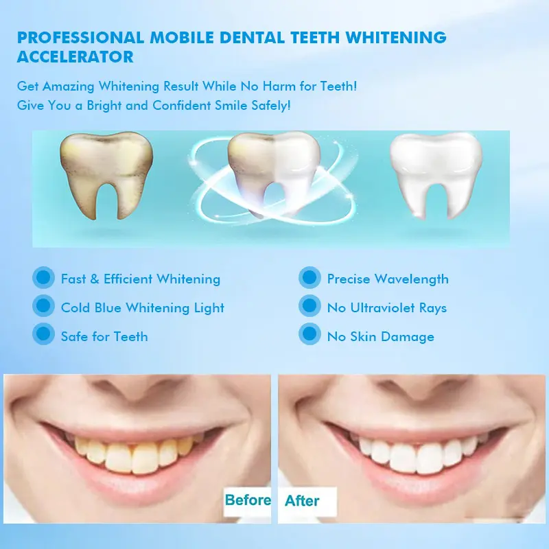 Professional High Power Dental LED Teeth Whitening Lamp Mobile Model For Clinic Salon Use